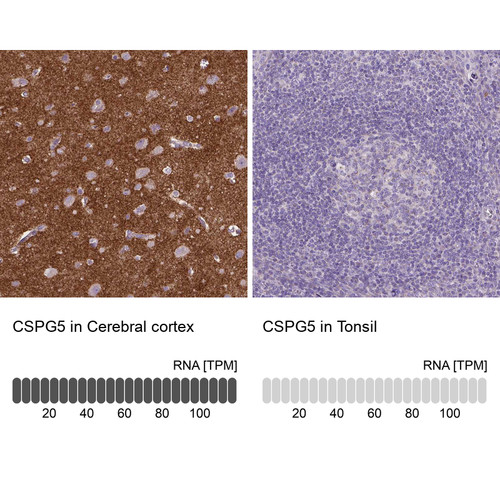 Immunohistochemistry analysis in human cerebral cortex and tonsil tissues using HPA071779 antibody. Corresponding CSPG5 RNA-seq data are presented for the same tissues.