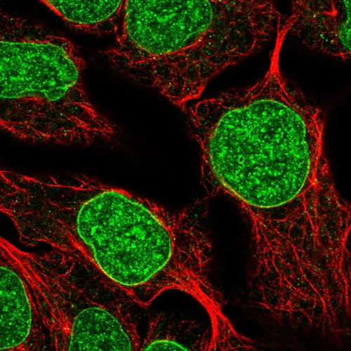 Immunofluorescent staining of human cell line RT4 shows localization to nucleus & nuclear membrane.