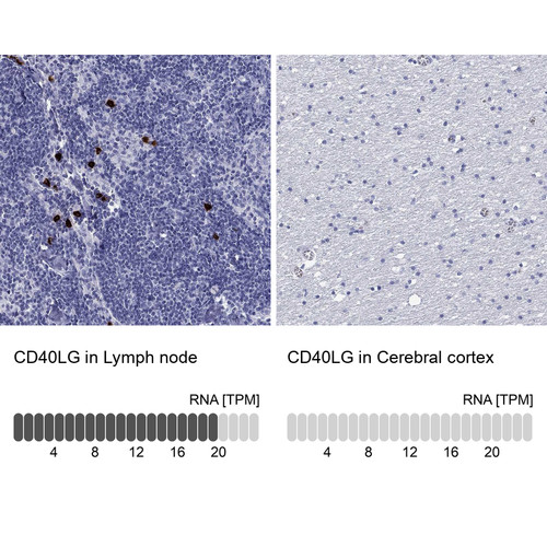 Immunohistochemistry analysis in human lymph node and cerebral cortex tissues using Anti-CD40LG antibody. Corresponding CD40LG RNA-seq data are presented for the same tissues.