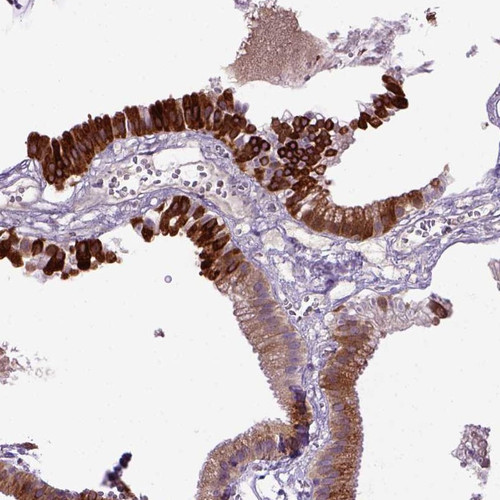 Immunohistochemical staining of human gallbladder shows cytoplasmic positivity in glandular cells.