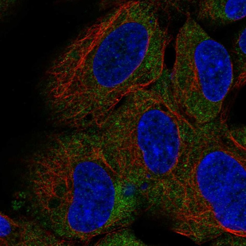 Immunofluorescent staining of human cell line HEK 293 shows localization to endoplasmic reticulum.