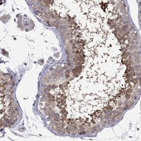 Immunohistochemical staining of human testis shows strong cytoplasmic positivity in cells in seminiferous ducts.