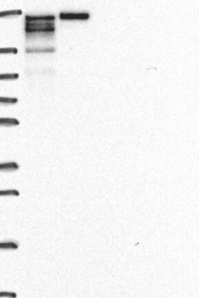 Lane 1: Marker [kDa] 250, 130, 95, 72, 55, 36, 28, 17, 10 | Lane 2: RT4 | Lane 3: U-251 MG | Lane 4: Human Plasma | Lane 5: Liver | Lane 6: Tonsil