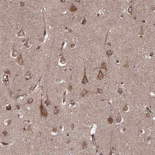 Immunohistochemical staining of human cerebral cortex shows strong cytoplasmic positivity in neuronal cells and glial cells.