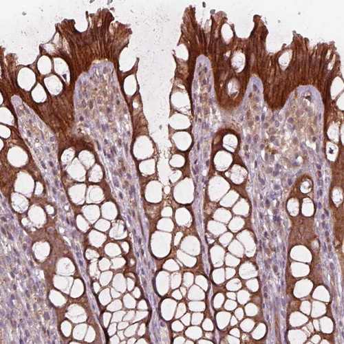 Immunohistochemical staining of human colon shows cytoplasmic positivity in glandular cells.