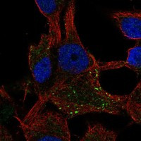 Immunofluorescent staining of human cell line SK-MEL-30 shows localization to vesicles.