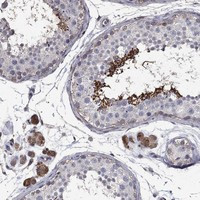 Immunohistochemical staining of human testis shows strong cytoplasmic positivity in cells in seminiferous ducts and Leydig cells.