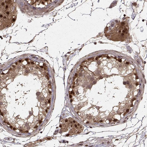 Immunohistochemical staining of human testis shows strong nuclear and cytoplasmic positivity in cells in seminiferous ducts and Leydig cells.