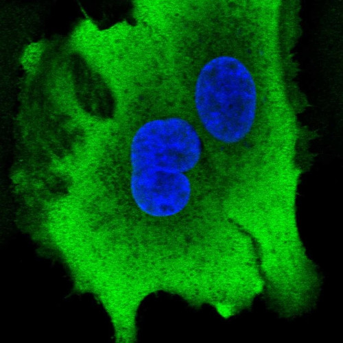 Immunofluorescent staining of human cell line A549 shows localization to plasma membrane & cytosol.