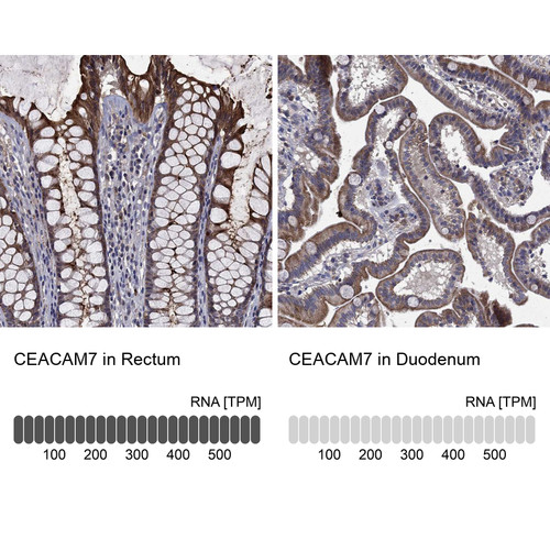 Immunohistochemistry analysis in human rectum and duodenum tissues using Anti-CEACAM7 antibody. Corresponding CEACAM7 RNA-seq data are presented for the same tissues.