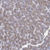 Immunohistochemical staining of human liver shows moderate cytoplasmic positivity in hepatocytes.