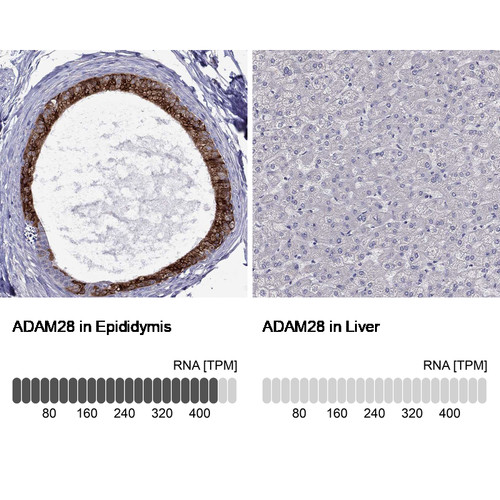 Immunohistochemistry analysis in human epididymis and liver tissues using Anti-ADAM28 antibody. Corresponding ADAM28 RNA-seq data are presented for the same tissues.