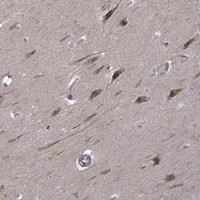 Immunohistochemical staining of human hippocampus shows strong cytoplasmic positivity in neuronal cells.
