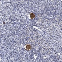 Immunohistochemical staining of human ovary shows strong positivity in follicle cells.