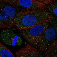 Immunofluorescent staining of human cell line EFO-21 shows localization to vesicles.
