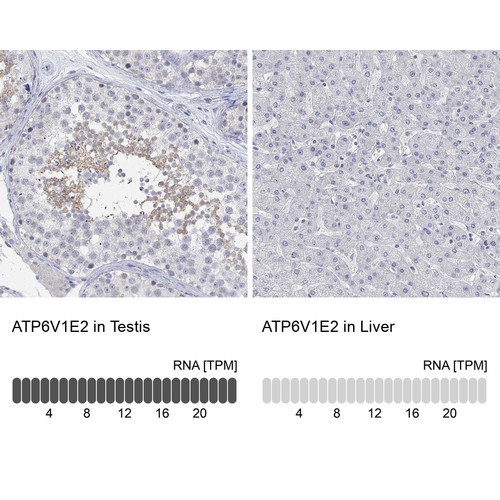 Immunohistochemistry analysis in human testis and liver tissues using Anti-ATP6V1E2 antibody. Corresponding ATP6V1E2 RNA-seq data are presented for the same tissues.