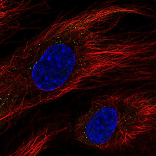 Immunofluorescent staining of human cell line HUVEC TERT2 shows localization to vesicles.
