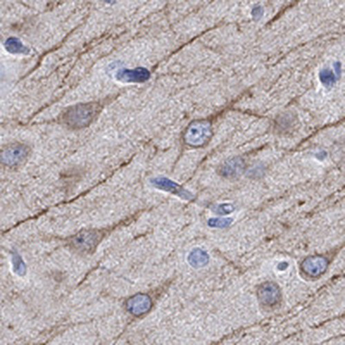 Immunohistochemical staining of human cerebral cortex shows moderate cytoplasmic positivity in neuronal cells.