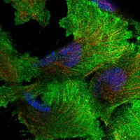 Immunofluorescent staining of human cell line U-251 MG shows localization to plasma membrane, actin filaments & vesicles.