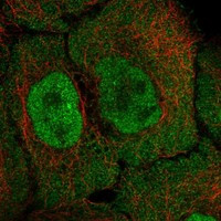 Immunofluorescent staining of human cell line A-431 shows localization to nucleoplasm & cytosol.
