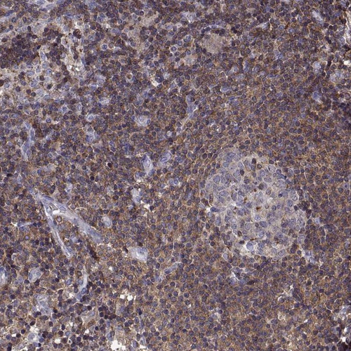 Immunohistochemical staining of human lymph node shows strong cytoplasmic positivity in germinal center and non-germinal center cells.