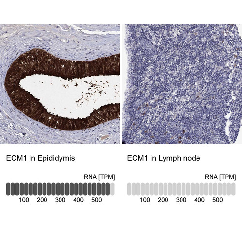 Immunohistochemistry analysis in human epididymis and lymph node tissues using Anti-ECM1 antibody. Corresponding ECM1 RNA-seq data are presented for the same tissues.