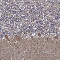 Immunohistochemical staining of human cerebellum shows strong cytoplasmic positivity in Purkinje cells and neuropil.