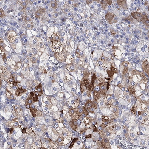 Immunohistochemical staining of human adrenal gland shows strong cytoplasmic positivity in medulla.