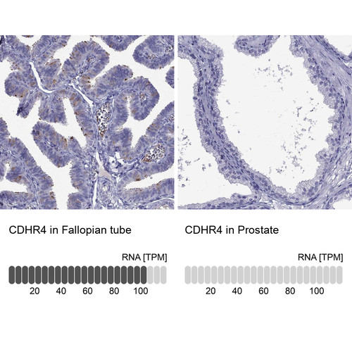 Immunohistochemistry analysis in human fallopian tube and prostate tissues using Anti-CDHR4 antibody. Corresponding CDHR4 RNA-seq data are presented for the same tissues.