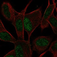 Immunofluorescent staining of human cell line SH-SY5Y shows localization to nucleoplasm.
