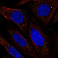 Immunofluorescent staining of human cell line SiHa shows localization to vesicles.