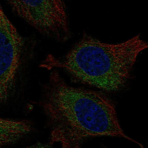 Immunofluorescent staining of human cell line SiHa shows localization to endoplasmic reticulum.