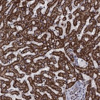 Immunohistochemical staining of human liver shows strong cytoplasmic positivity with a granular pattern in hepatocytes.