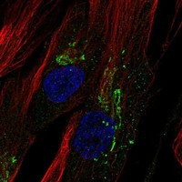 Immunofluorescent staining of human cell line ASC TERT1 shows localization to the Golgi apparatus.