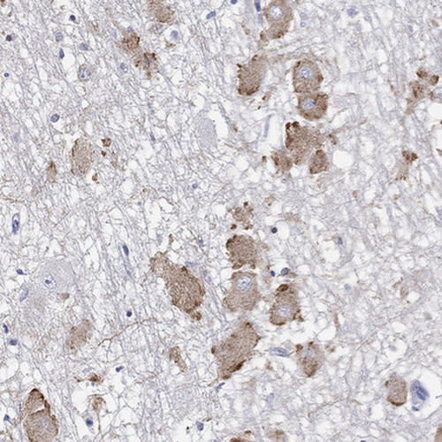 Immunohistochemical staining of human hypothalamus shows strong cytoplasmic positivity in neurons.