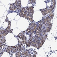 Immunohistochemical staining of human parathyroid gland shows strong membranous and cytoplasmic positivity in glandular cells.