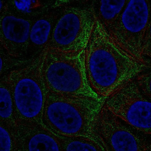 Immunofluorescent staining of human cell line MCF7 shows localization to intermediate filaments.