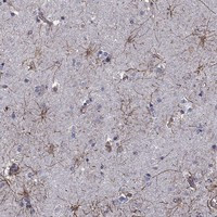 Immunohistochemical staining of human caudate shows strong positivity in astrocytes.