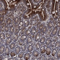 Immunohistochemical staining of human small intestine shows strong cytoplasmic positivity in glandular cells.