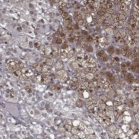 Immunohistochemical staining of human adrenal gland shows strong cytoplasmic positivity in glandular cells in cortex.