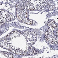 Immunohistochemical staining of human testis shows moderate cytoplasmic positivity in cells in seminiferous ducts.