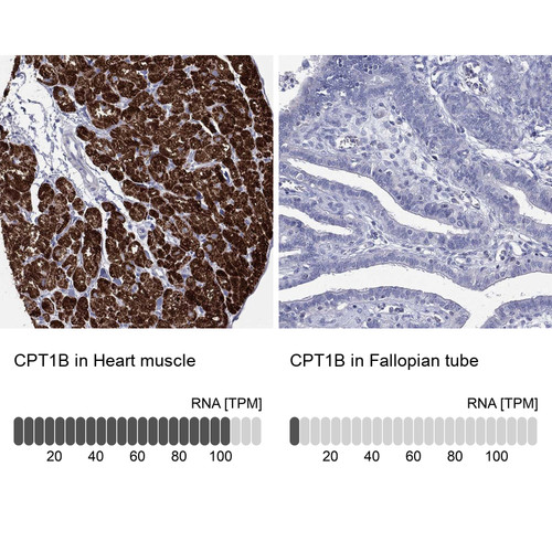 Immunohistochemistry analysis in human heart muscle and fallopian tube tissues using Anti-CPT1B antibody. Corresponding CPT1B RNA-seq data are presented for the same tissues.