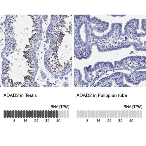 Immunohistochemistry analysis in human testis and fallopian tube tissues using Anti-ADAD2 antibody. Corresponding ADAD2 RNA-seq data are presented for the same tissues.