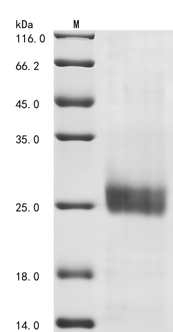 (Tris-Glycine gel) Discontinuous SDS-PAGE (reduced) with 5% enrichment gel and 15% separation gel.