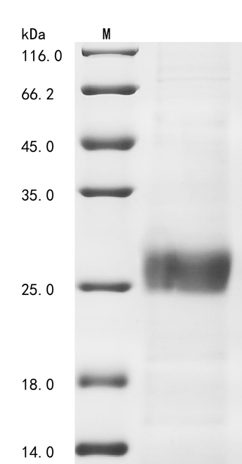 (Tris-Glycine gel) Discontinuous SDS-PAGE (reduced) with 5% enrichment gel and 15% separation gel.