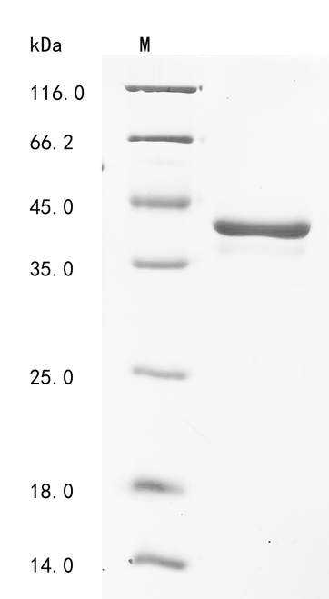 (Tris-Glycine gel) Discontinuous SDS-PAGE (reduced) with 5% enrichment gel and 15% separation gel.
