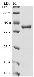 (Tris-Glycine gel) Discontinuous SDS-PAGE (reduced) with 5% enrichment gel and 15% separation gel.