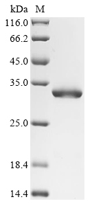 (Tris-Glycine gel) Discontinuous SDS-PAGE (reduced) with 5% enrichment gel and 15% separation gel.