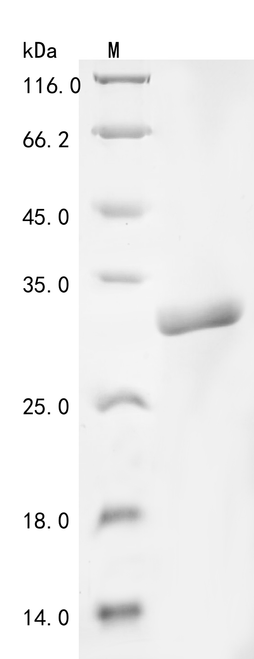 (Tris-Glycine gel) Discontinuous SDS-PAGE (reduced) with 5% enrichment gel and 15% separation gel.