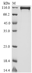 Recombinant Human Dipeptidyl peptidase 4 (DPP4) (CSB-MP007139HU1)